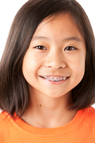 Braces Soldotna