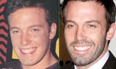BenAffleck
