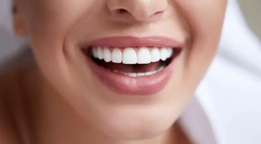 img Teeth Whitening lp